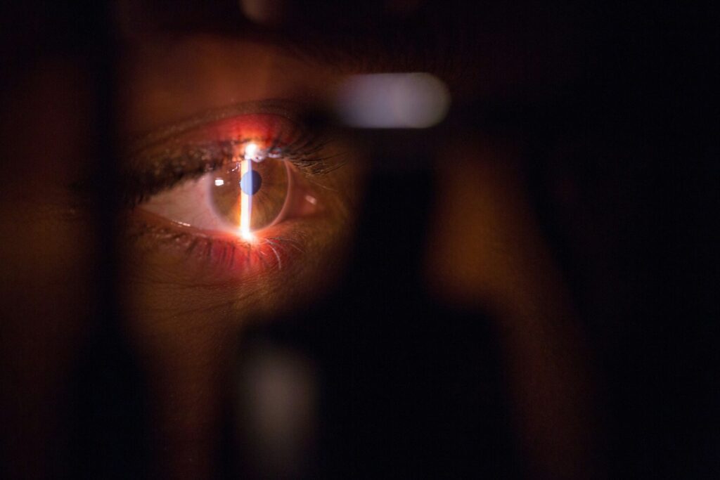 LASIK